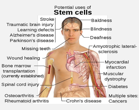 Stem Cell Uses